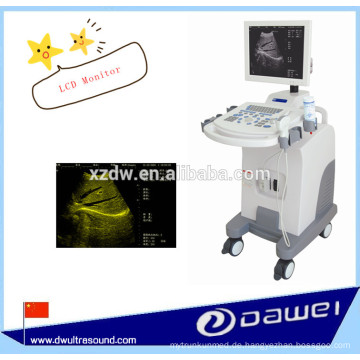 Volldigitaler Trolley Ultraschall Scanner zum Verkauf